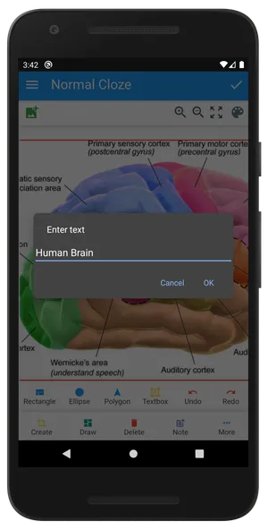 Anki Image Occlusion